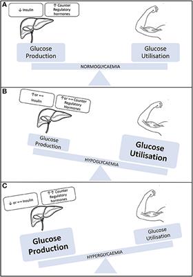 Exercise Management for Young People With Type 1 Diabetes: A Structured Approach to the Exercise Consultation